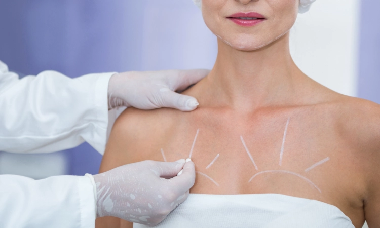 Breast Augmentation
