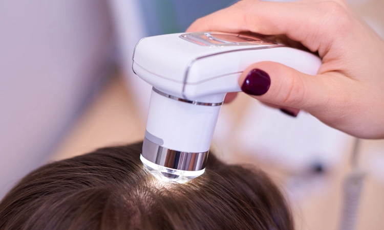 Laser Hair Rejuvenation