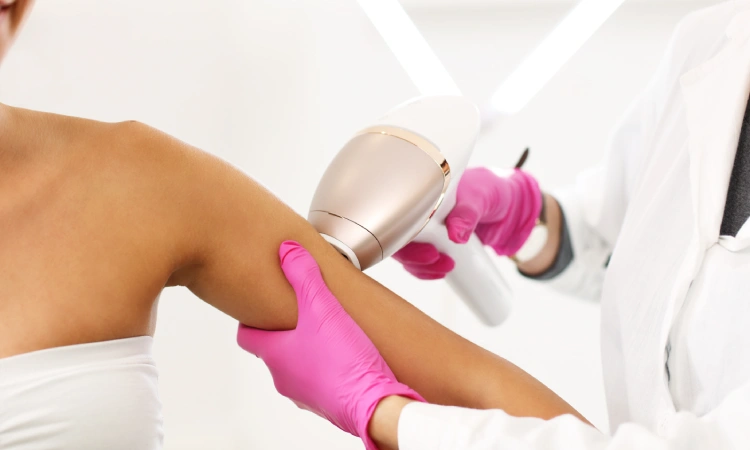 Laser Hair Removal