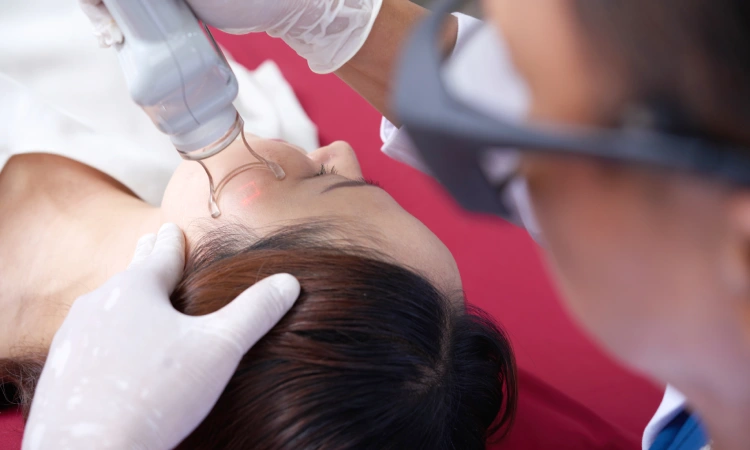 Laser Skin Resurfacing